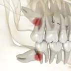 עבודה של יצחק, רופא שיניים (6)