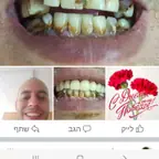 עבודה של דביר, רופא שיניים (1)