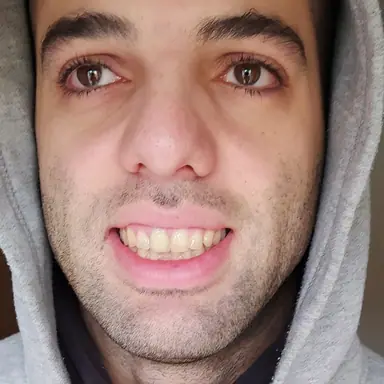 עבודה של טל, רופא שיניים (1)