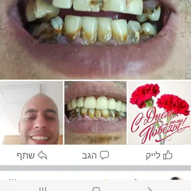 עבודה של דביר, רופא שיניים (1)